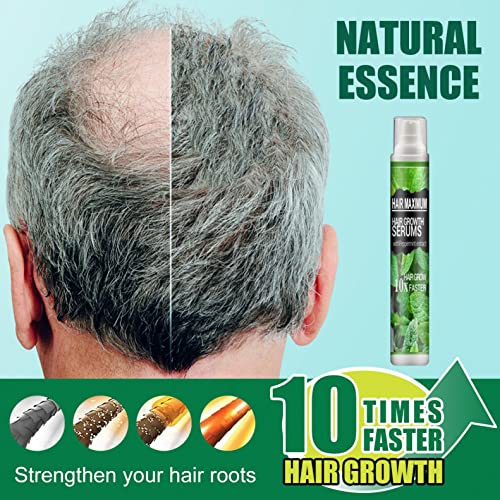 Sprej za kosu, biljni sprej za esenciju rasta kose za Prevent Postpartum gubitak kose linije kose biljni sprej za esenciju kose 10ml