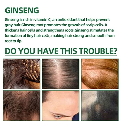 3kom KORTIN Red Ginseng sprej za regeneraciju kose, KORTIN Red Ginseng sprej za regeneraciju kose, Hyungang Korea Ginseng Serum za ponovni rast kose, Serum za sprej za rast kose od đumbira za žene & amp; muškarci