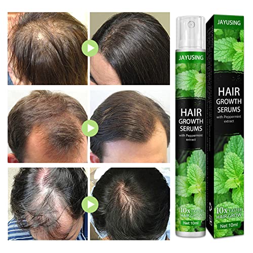 Nana serumi za rast kose prirodni rast kose ulje za njegu kose neophodan za zaustavljanje opadanja kose, promoviše rast kose, popravi